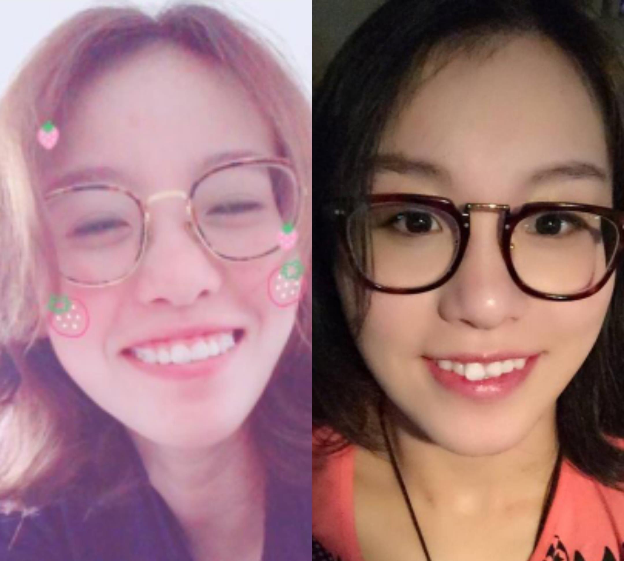 傅园慧|25岁傅园慧自曝毁容，嘴巴肿成香肠闭不上，胸前一片红肿