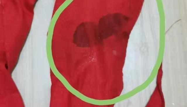 Sasha的运动 一道错题引发的悲剧：二年级女生被老师打伤，险些失明