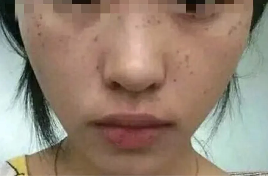 蛋糕裙 护肤指南｜原来这么多的问题归根结底都跟“皮肤微生态”有关！