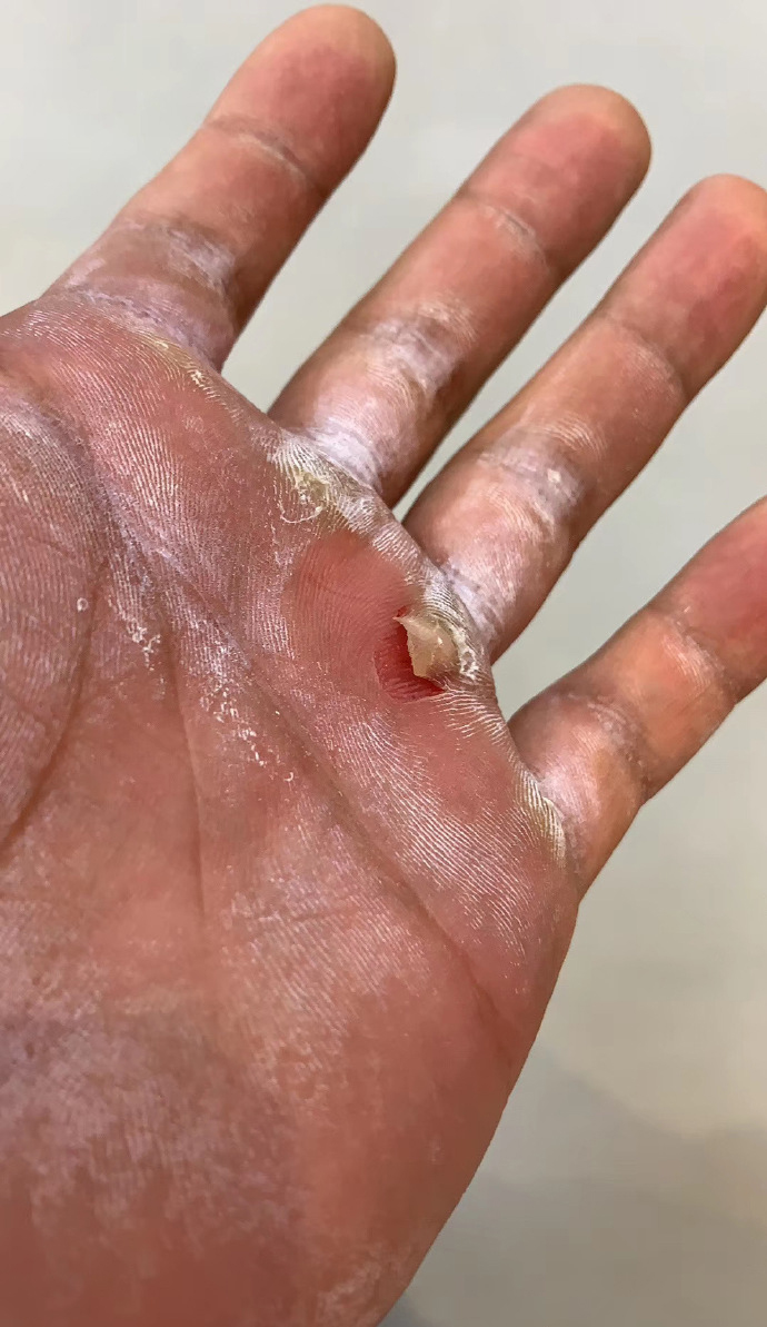 健身圈一哥|撸铁磨破手掌是常事,咬牙也要坚持,健体冠军的麒麟臂堪比大腿!