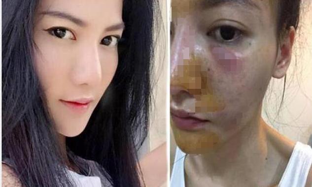 好物官|女子为变白狂打6年美白针，如今变成什么样了？网友：不敢相信