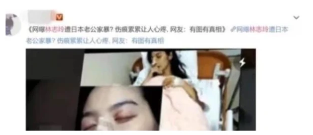 林志玲|林志玲遭日本老公家暴？因长久不能怀孕，导致婆婆嫌弃