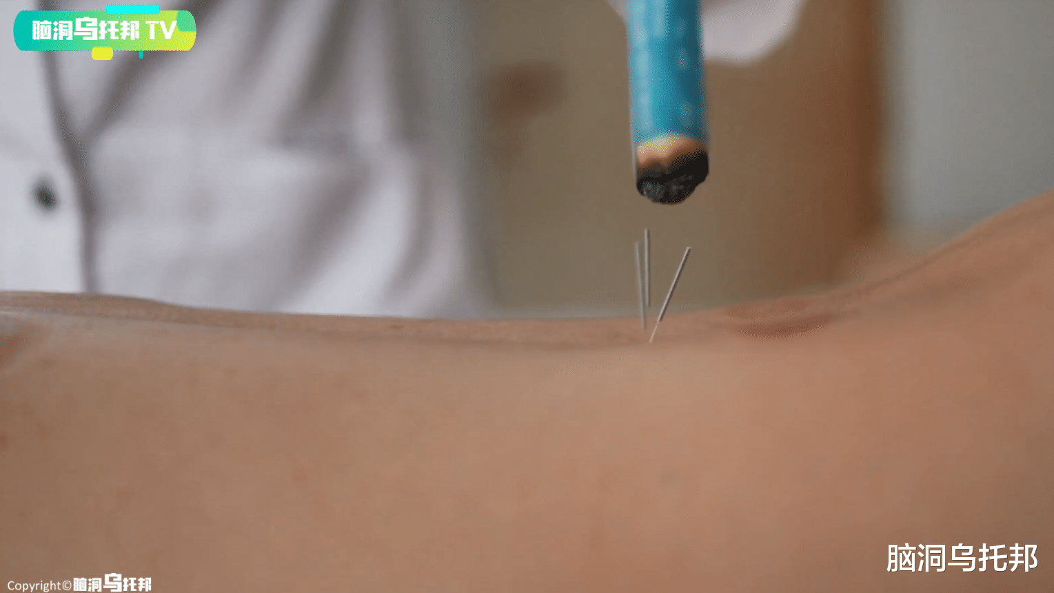 经络|主宰生死的隐形器官！人体灵魂之所在，现代医学无法复刻的医术