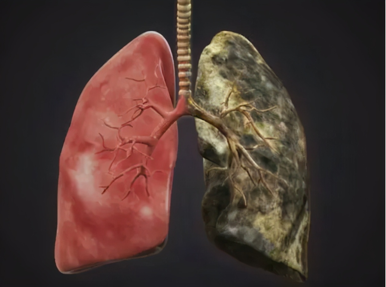 抗癌|尼古丁\害怕\1种水，并非银耳羹，平常任性喝，尼古丁乖乖排出，肺病不敢造次