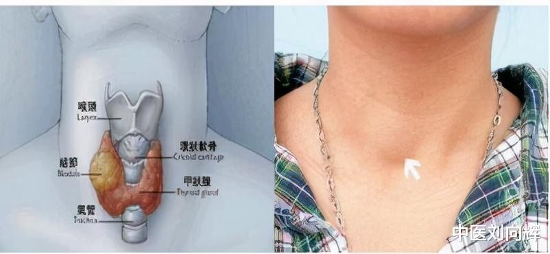 菠菜|人间百病，皆因肝郁！用一张疏肝理气的方子，调肝理气，散结节