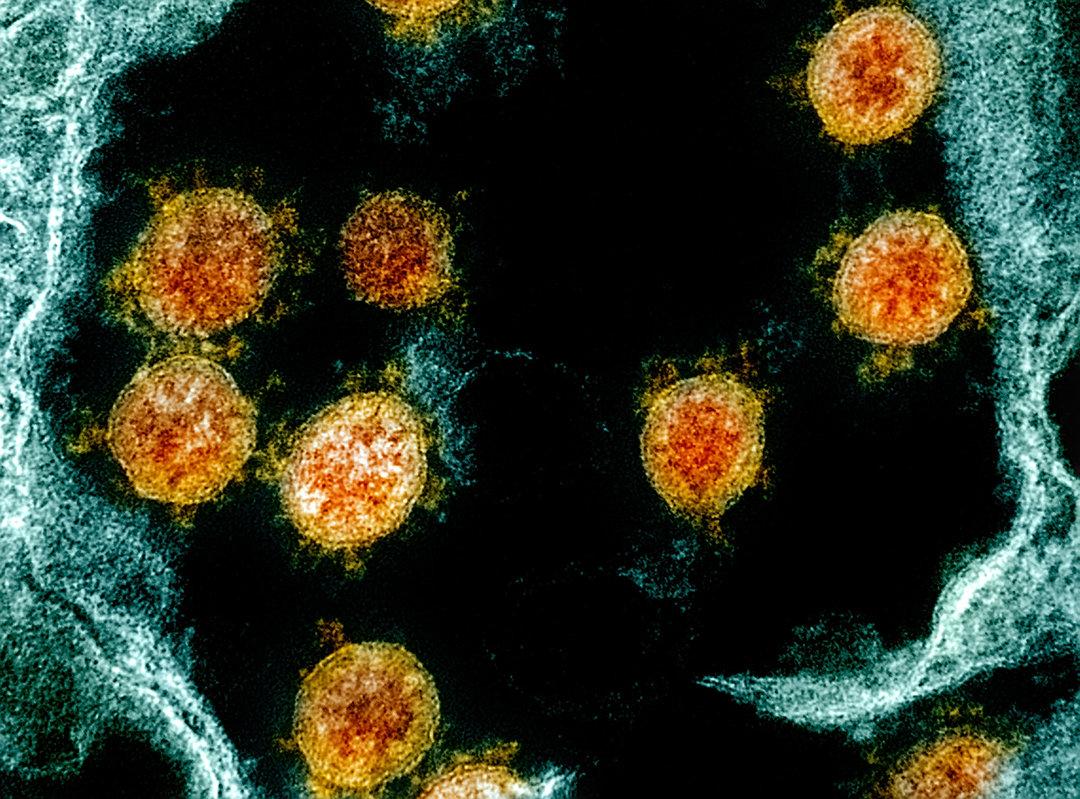 冠状病毒 英国科学家：冠状病毒疫情早在21000年前爆发，东亚人的DNA有印记
