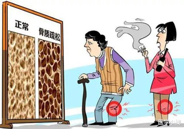 医学小栈|女性45岁后需养骨，营养师提醒：3种食物多吃，或能腰膝不酸软