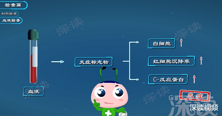 深读视频|啪后腹痛恐是盆腔炎？盆腔炎该如何确诊？治疗期间要注意啥？动漫解读