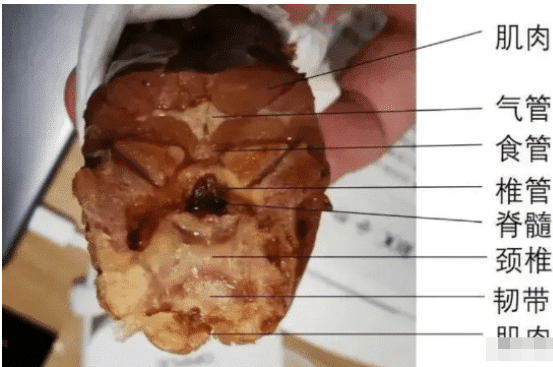 秃顶|“为什么秃顶的宁愿留一圈头发，也不愿意推光头？”哈哈哈神评是个人才