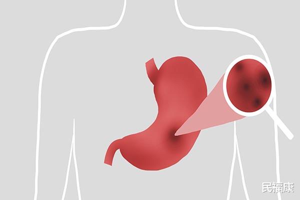 补水 女子过午不食，5年后，除了体重变轻，身体还获得了什么？