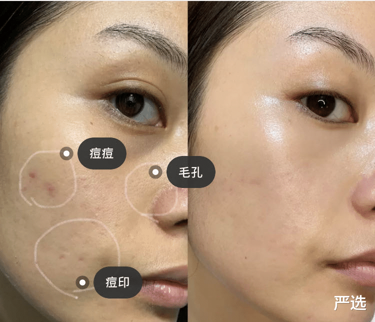 严选|泰国身价3百亿的81岁富婆,整容9年只为“皮肤回春”,如今啥样了