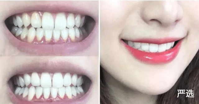 严选 刷牙前,牙膏要“沾水”吗?专家:有人刷了一辈子牙,也没搞明白