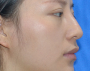 卦解人生|了解什么样的面相会晚婚