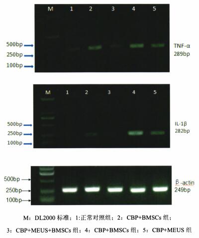 前列腺炎|被前列腺炎“找上门”，看看干细胞疗法在干预前列腺炎会是怎样的效果