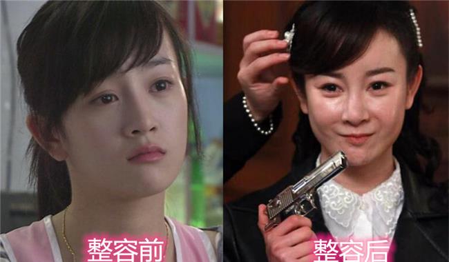 唐嫣|《夏家三千金》10年，唐嫣邱泽各自有家庭，只是她把脸折腾垮了