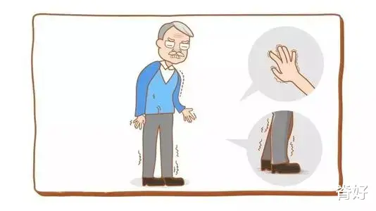 剪刀步|5种怪异步态，暗藏健康危机？