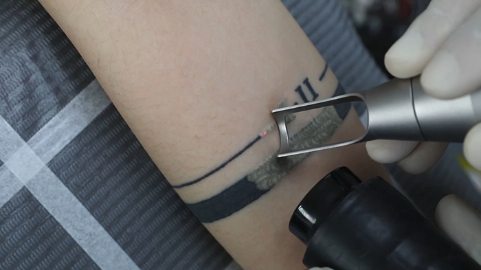 齐姐育儿|13岁女孩背着妈妈偷偷纹身，被告知需要两年时间清洗，且还会留疤