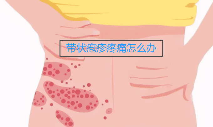 皮肤科李大夫|一味药帮你解决带状疱疹疼痛