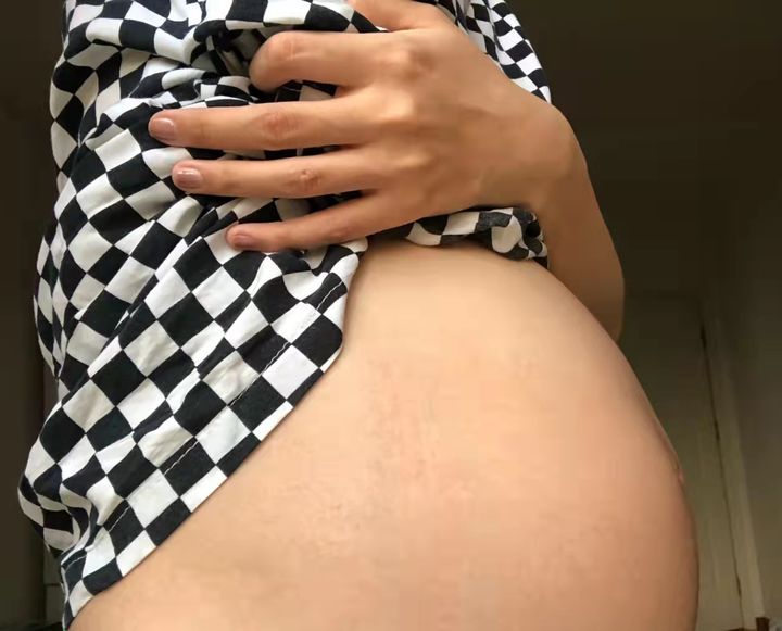 希希和念念|妊娠纹要花几万块修复？孕期做好这三件事，产后安心穿比基尼！