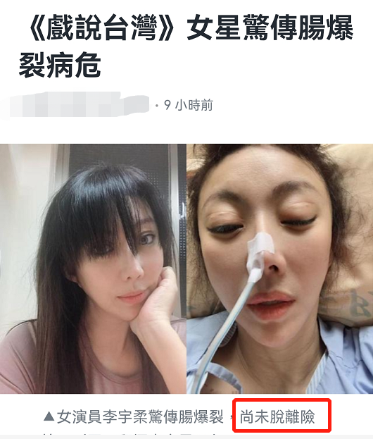 重症监护室|49岁台女星突曝病危，因肠爆裂紧急开刀进ICU，曾为生子流产10次
