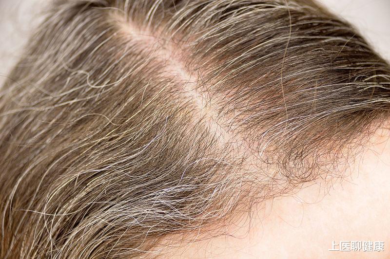 肝脏|肝脏大病找上门,身体4个地方会先漏马脚!养肝牢记这4点,拖不得