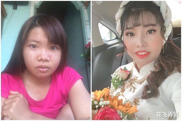 整容|5年前，越南丑女整容后秒嫁富豪，半年后遭抛弃，如今怎样了？