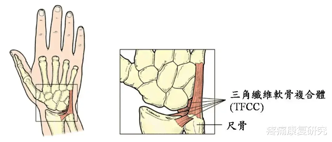 便秘|三角纤维软骨损伤与康复治疗