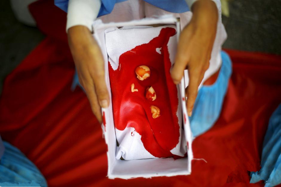 科学家 几个月大的胎儿算是人？科学家们对此争论百年！