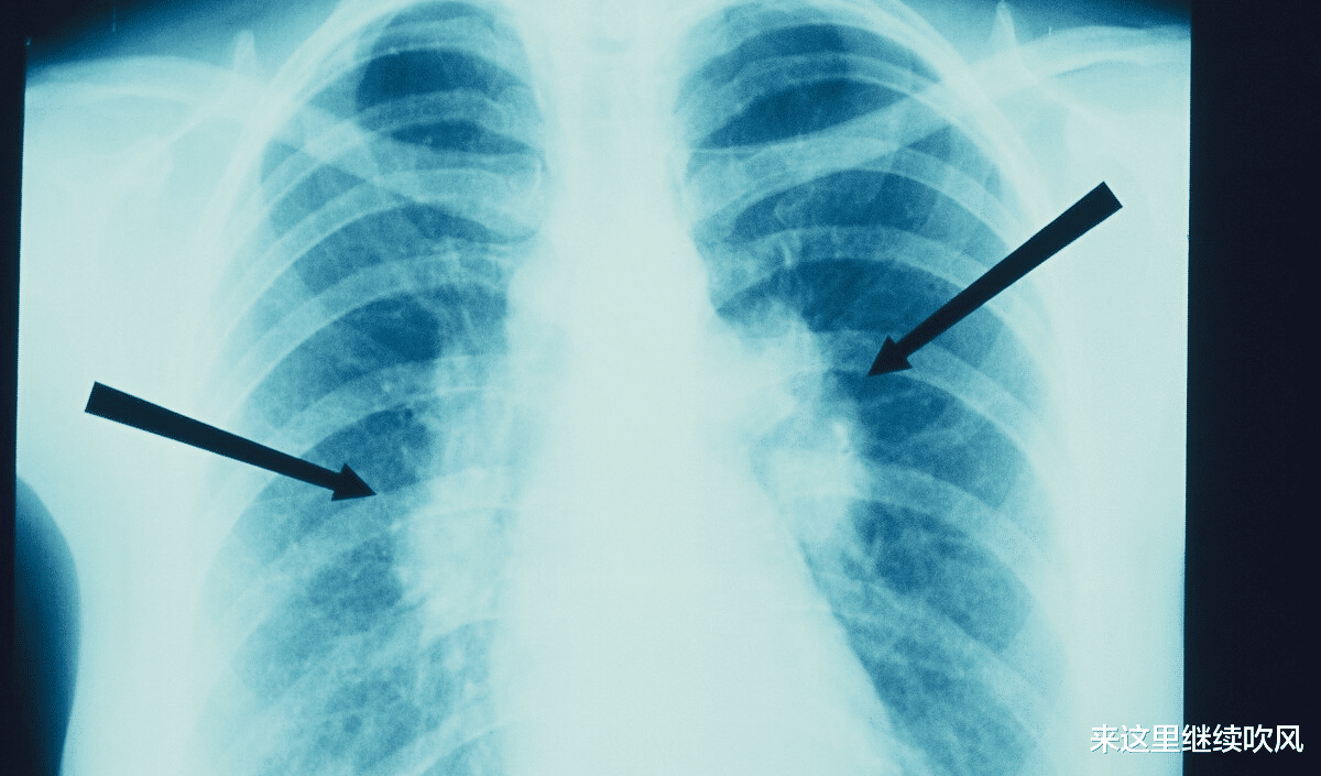 体检|提醒：体检发现多种毛病，不用慌，这9种毛病根本不用治