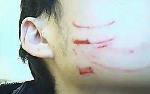 舜网 儿子的脸被同学“抓破相”，这位母亲的做法，让老师也心悦诚服