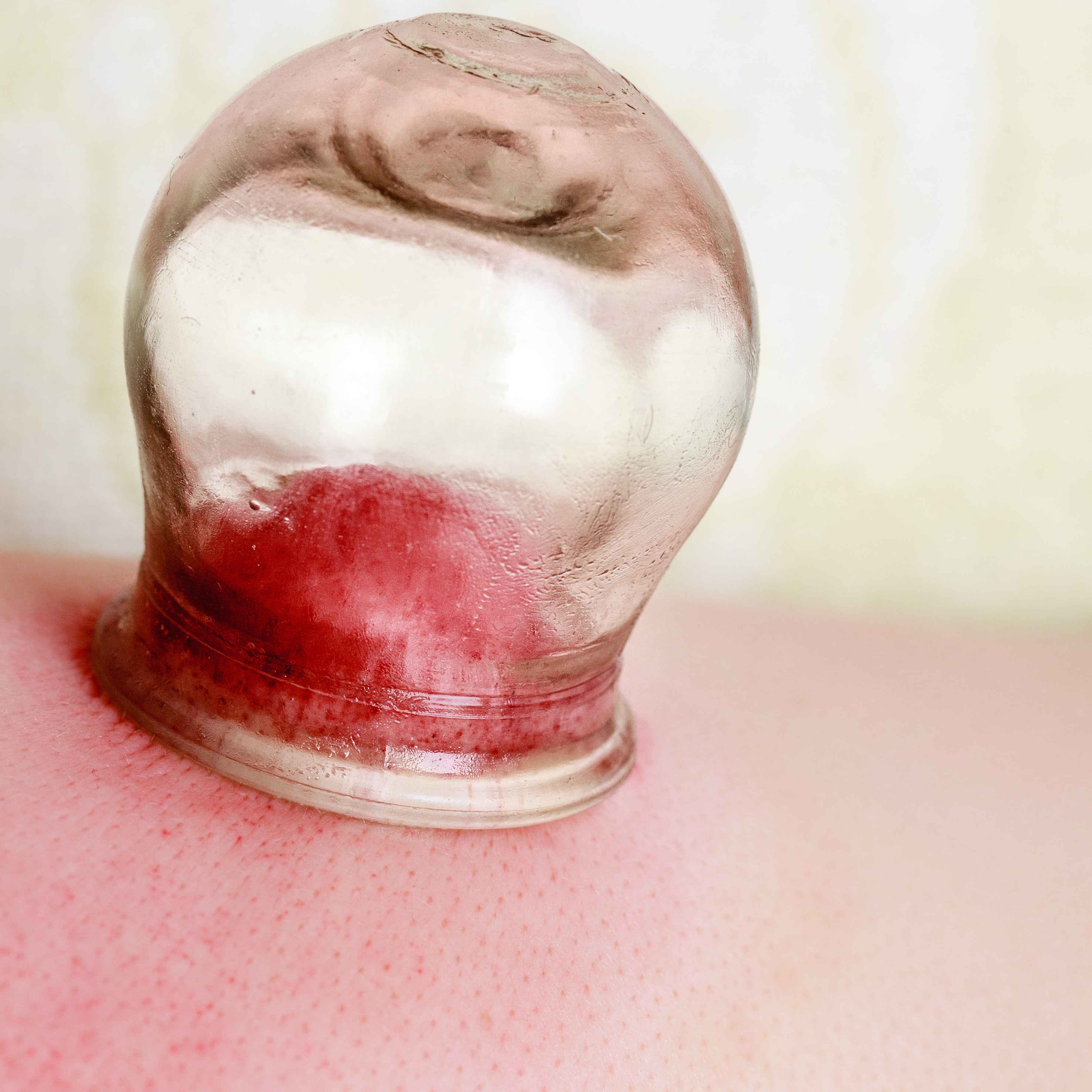 祛湿|身体出现这5种表现,或是湿气在“作祟”,占3个就要及时祛湿了