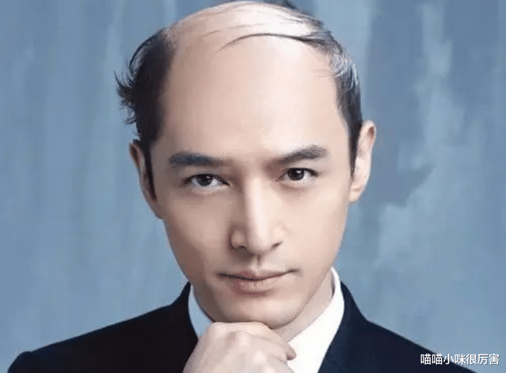明星|有刘海就别说颜值高了，让这5位明星告诉你，光头帅才是真好看