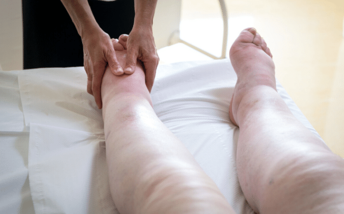 尿酸|40岁男子，尿酸降到了358，用了3个月的时间，大家应该学习他的方法