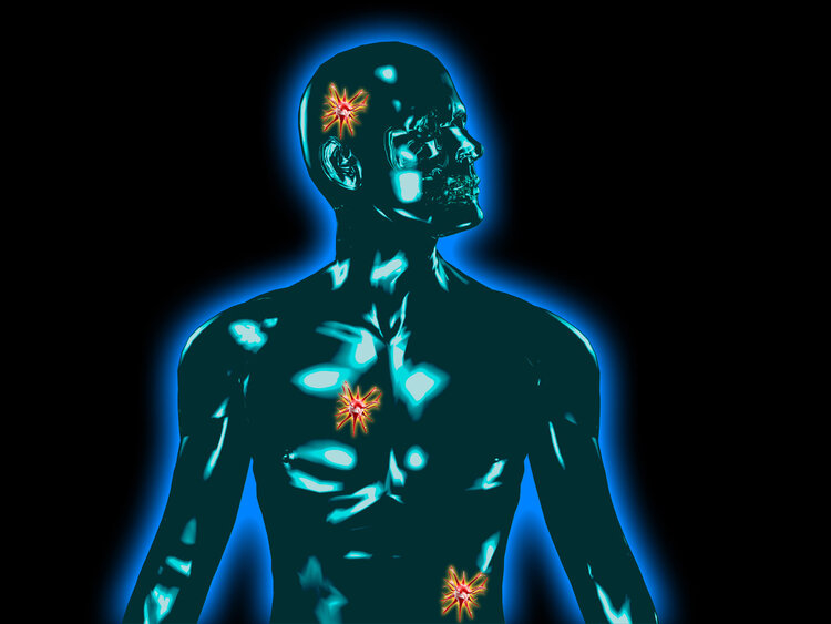 肿瘤|80岁患上肺癌，4年后肿瘤竟然自行消失了，癌症真的能自愈吗？