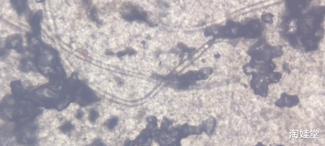 淘娃堂|肚脐眼里的“黑泥”是啥，不能抠掉吗？显微镜放大千倍后，真酸爽