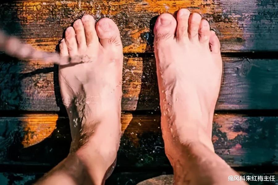 痛风科朱红梅主任|一直在治疗、痛风却没有得到有效治疗！