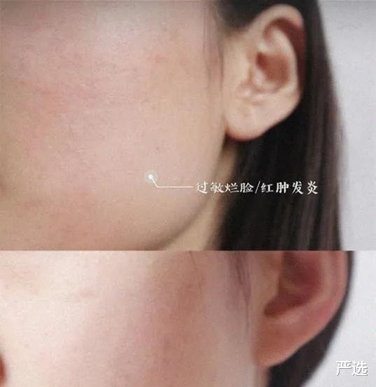 严选|军嫂张馨予发素颜照，“蛋清脸”吹弹可破，让人看了不禁想捏一捏
