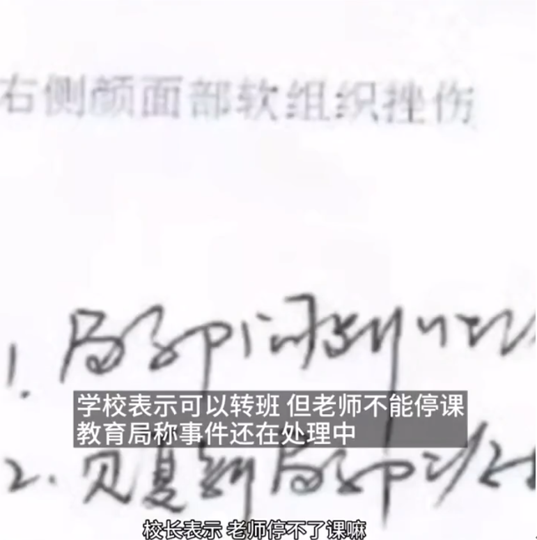 前沿大观察 师德？小学生遭数学老师殴打，家长：孩子现在经常半夜哭醒