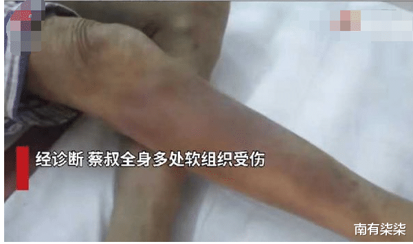 南有柒柒 恶劣！广东廉江黑中介男护工殴打六旬瘫痪老人，警方已介入调查