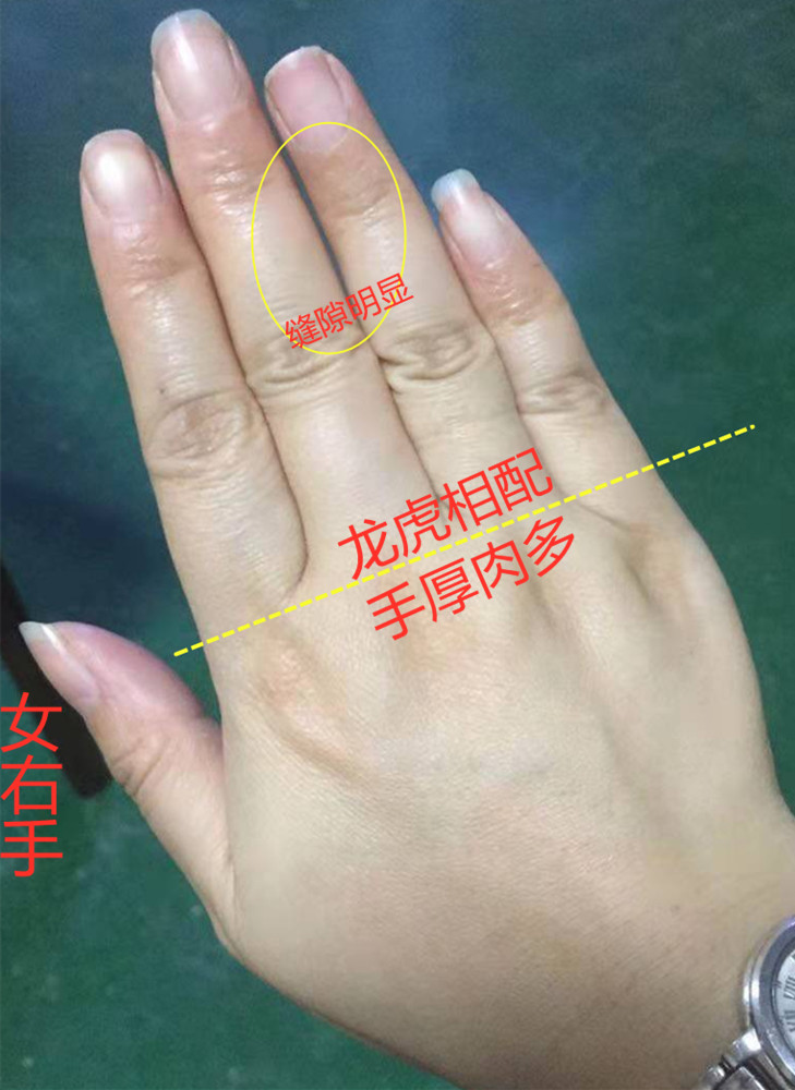 诚然情感之事|手相：结婚线分叉，谨防情路不畅，婚姻二度