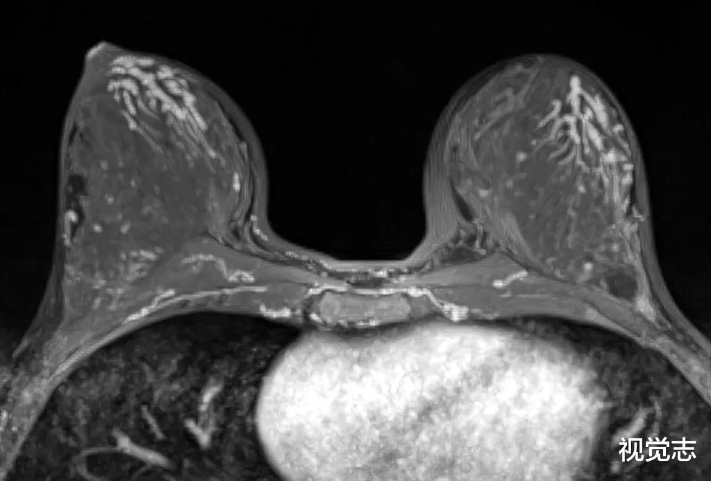 视觉志|拿到你的体检报告，小心「结节」二字。