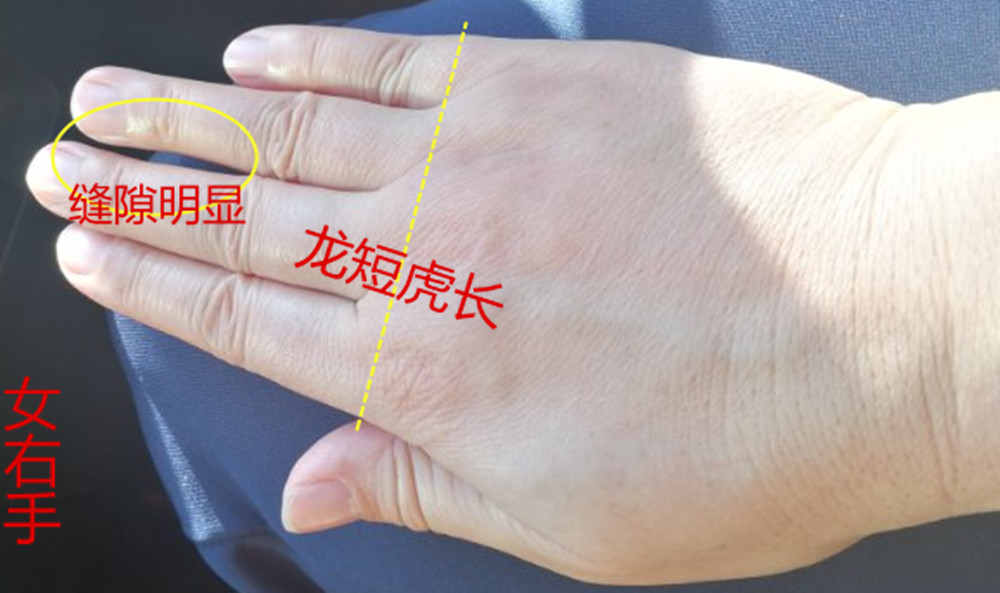 诚然情感之事|手相：M纹日子越过越好，米字纹衣食无忧的特征！