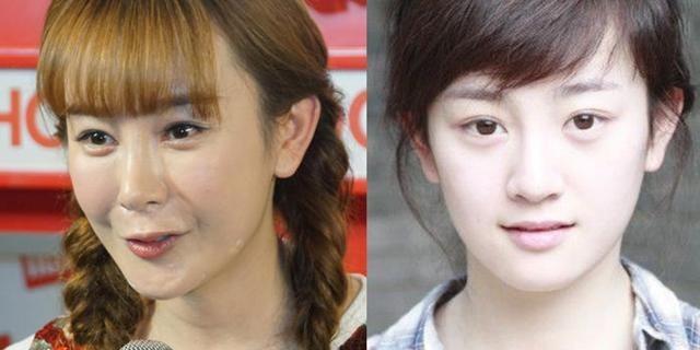 整容|脸成发面团，下巴能犁地？中老年女明星整容后遗症才是“重灾区”