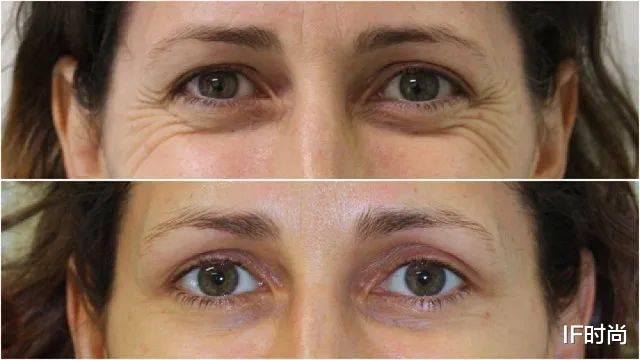 玛格特·罗比|她的走红，从“抽”小李子耳光开始……