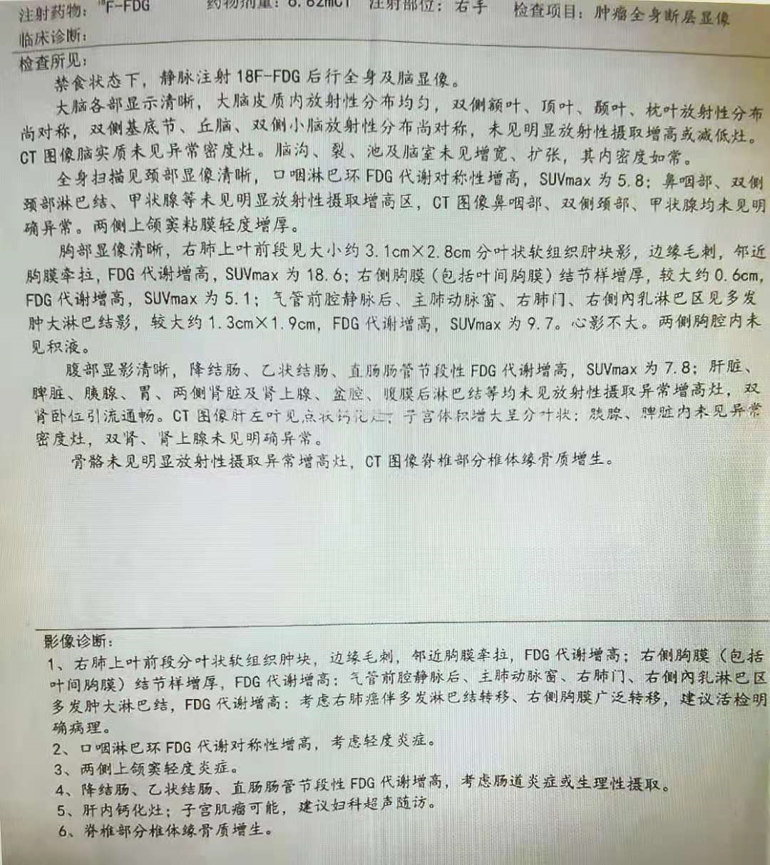 用户_胡洋|靶向耐药，45岁晚期肺癌病人使用化疗联合抗血管生成药物效果显著！