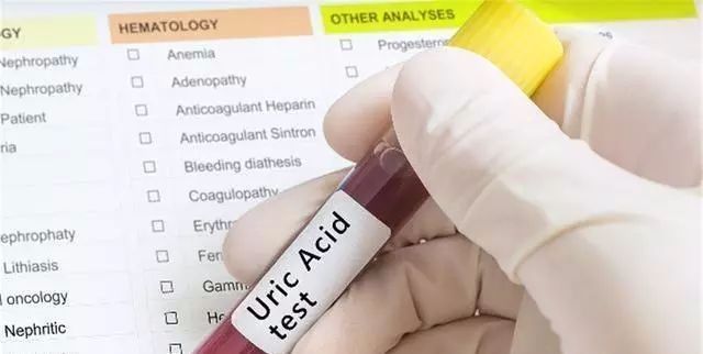 尿酸|尿酸升高，身体或有4个反应，若占上两个，提醒你该降尿酸了