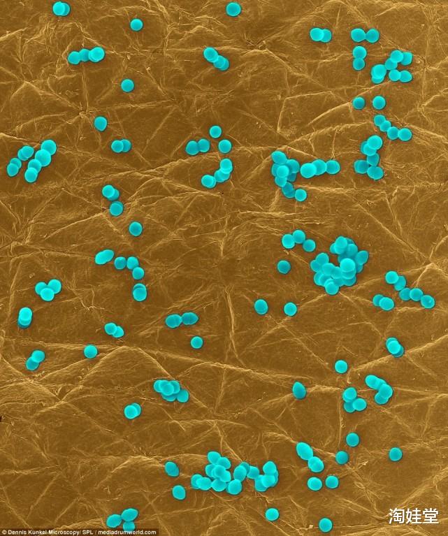 淘娃堂|肚脐眼里的“黑泥”是啥，不能抠掉吗？显微镜放大千倍后，真酸爽