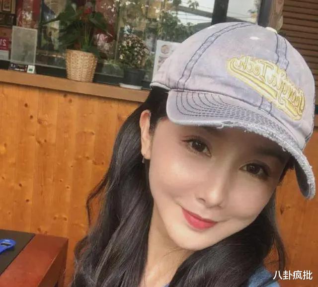 张雨绮|张雨绮脸僵鼻子怪，过度医美惹的祸？