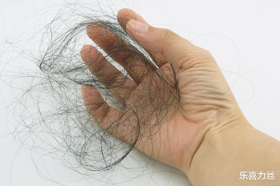 乐喜力丝|这些错误的脱发观,当真要不得!