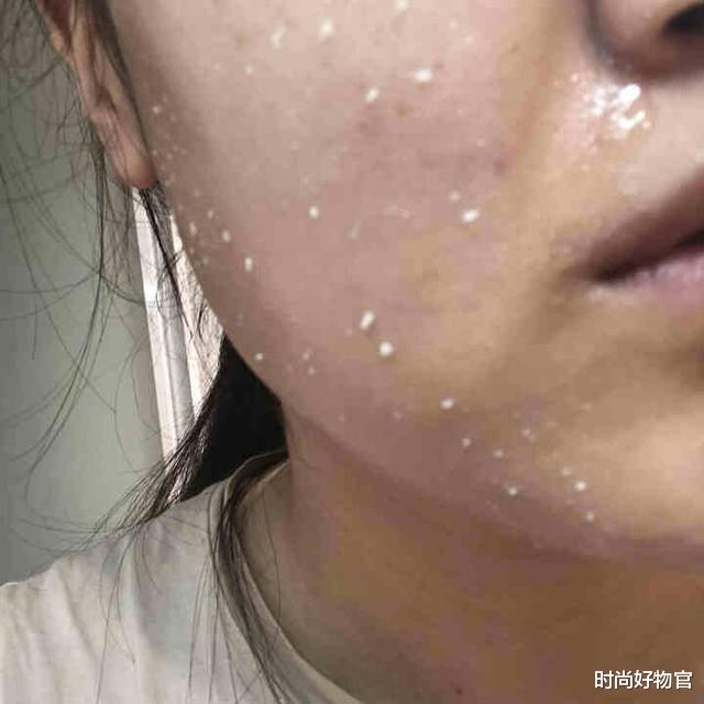 美甲 面部肌肤问题不断？可能是螨虫在作怪，学会这3个小技巧轻松除螨